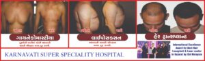 karnavati-hospital-portfolio-LASER